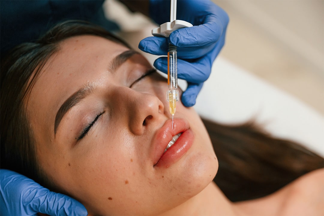 In Cooper City, a person with closed eyes receives a professional lip injection from someone wearing blue gloves at a renowned med spa.