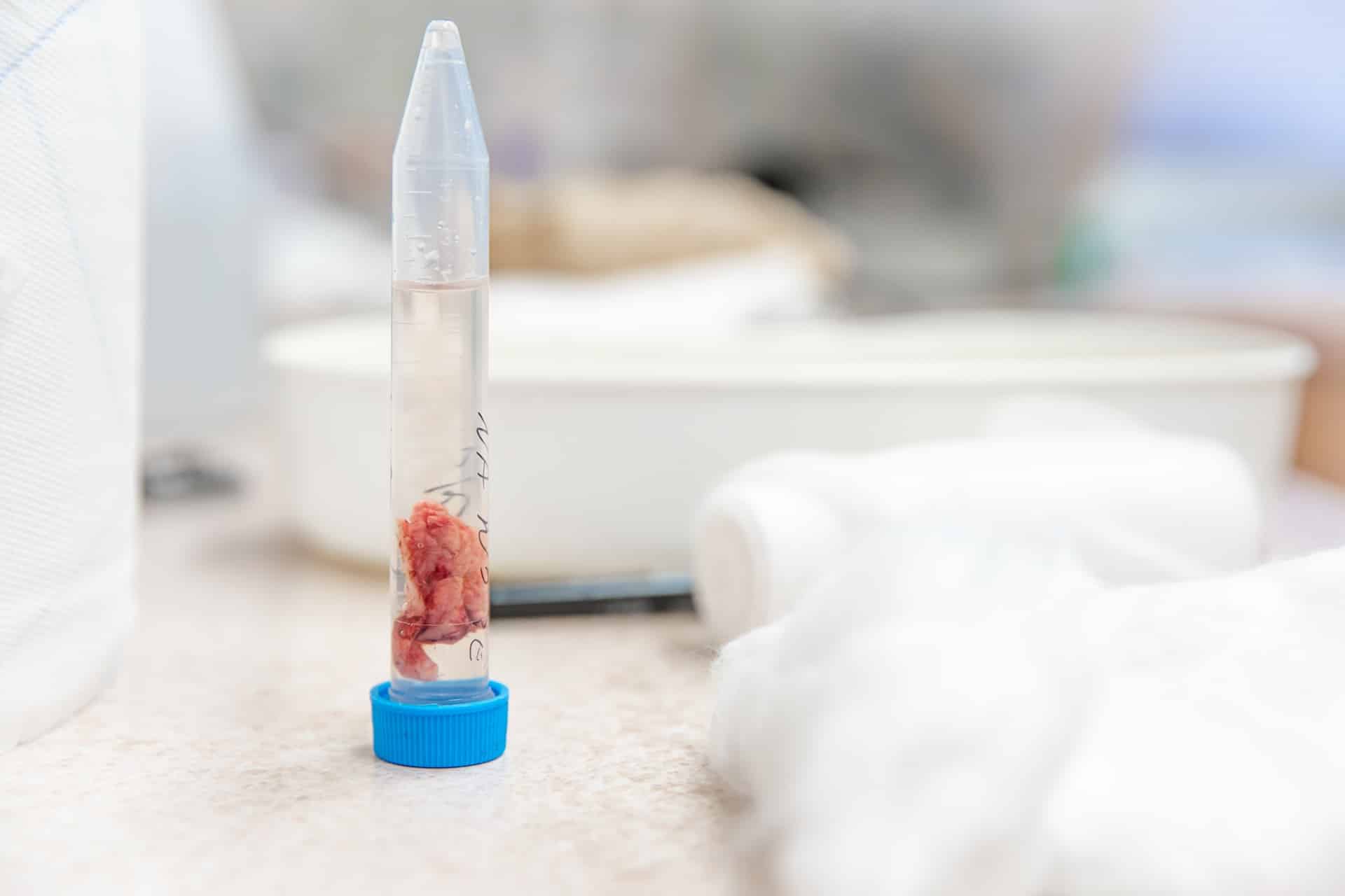 Close-up of a transparent tube with a blue cap containing a red substance, placed on a light-colored surface with out-of-focus medical supplies in the background. This scene is possibly related to GLP-1 agonists like Tirzepatide and may be found in medical settings such as med spas. For those in Cooper City interested in advanced treatments involving GLP-1 agonists, local med spas provide specialized services utilizing cutting-edge therapies for wellness and health optimization.